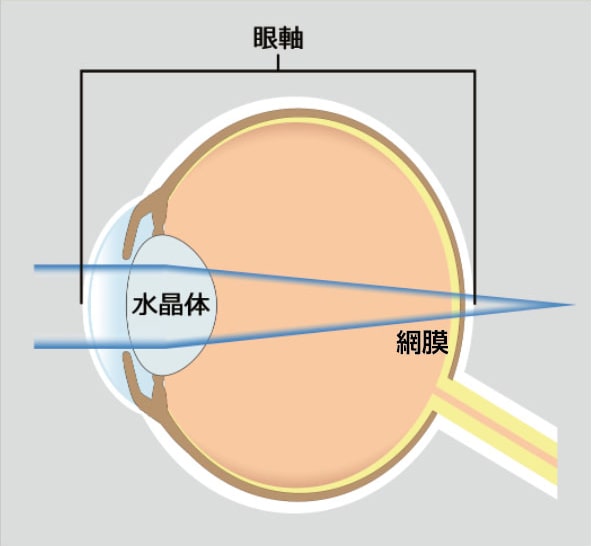 遠視