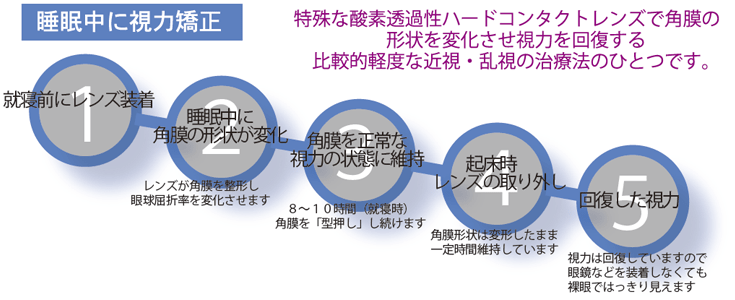 睡眠中に視力矯正